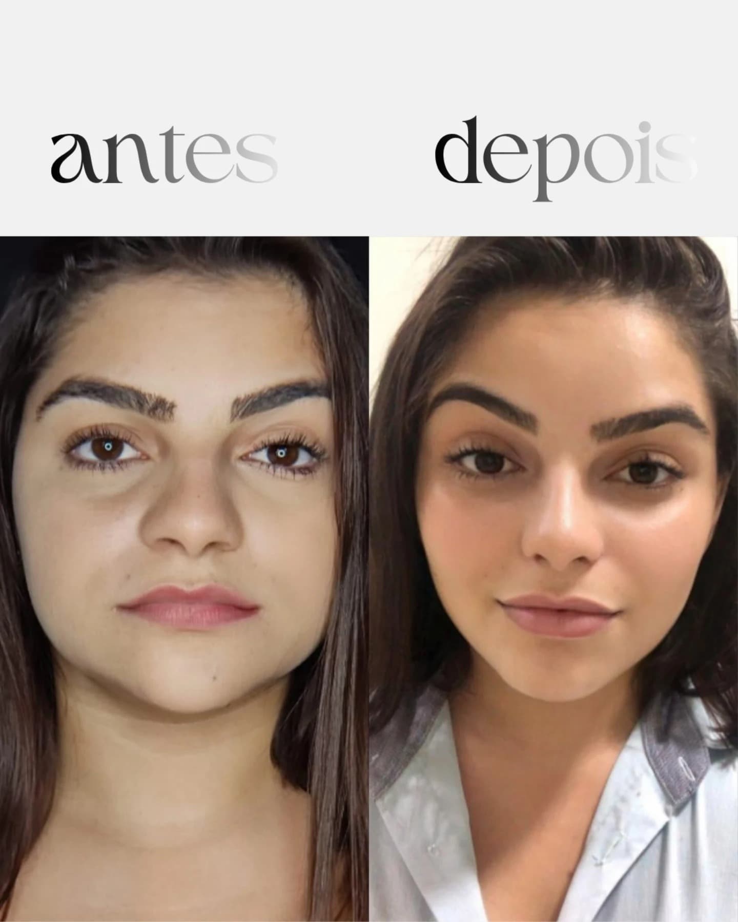 Antes / Depois