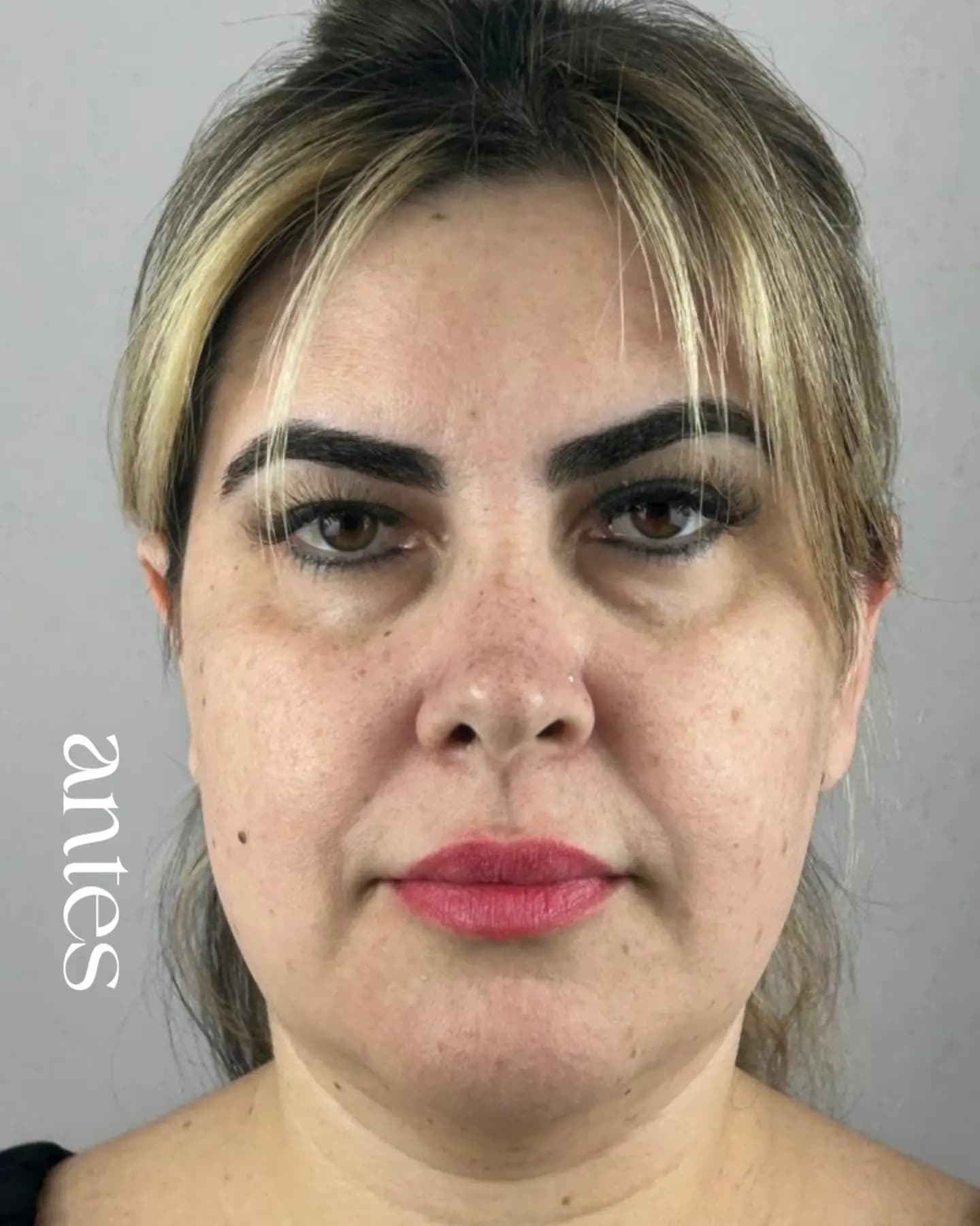 Antes