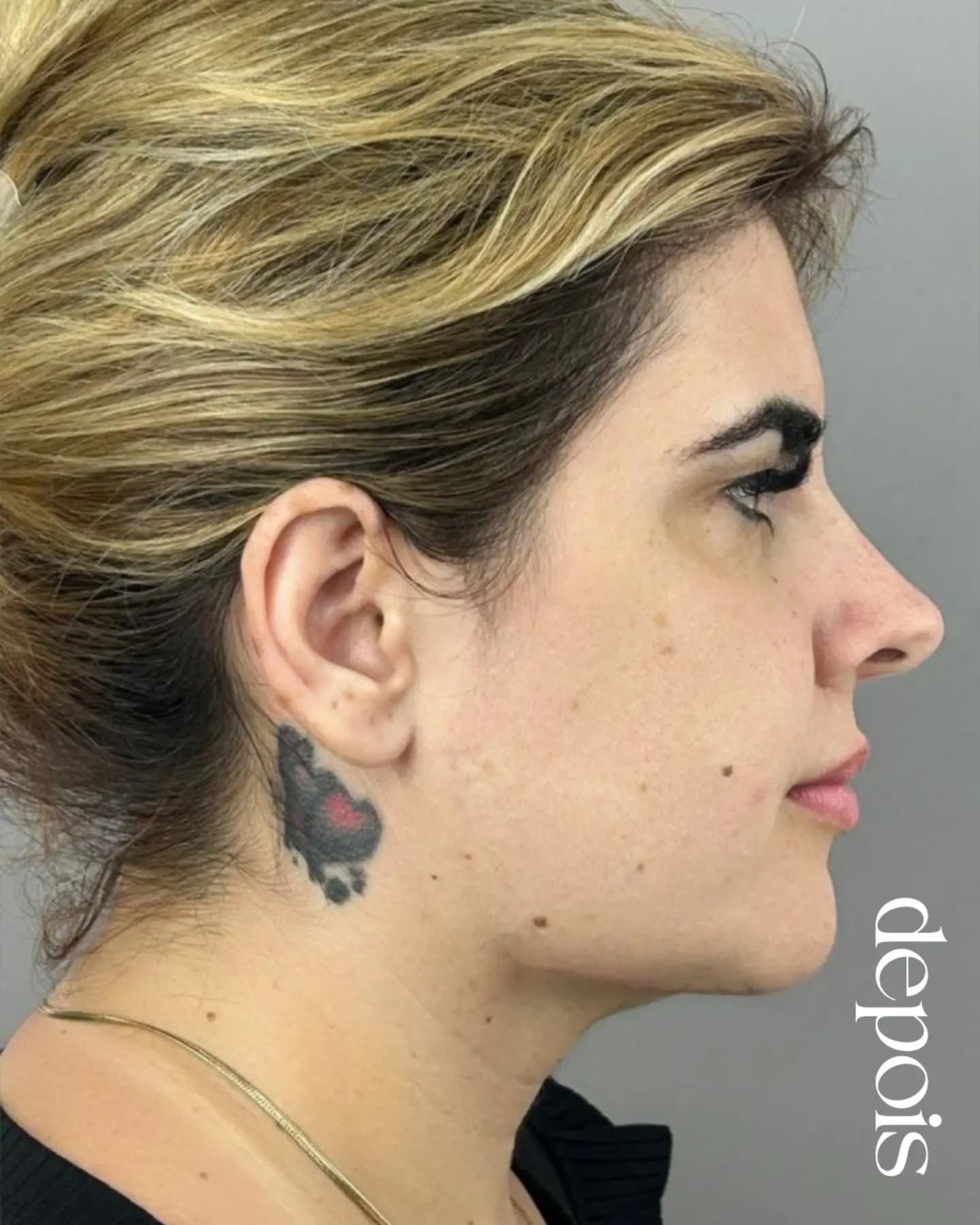 Depois