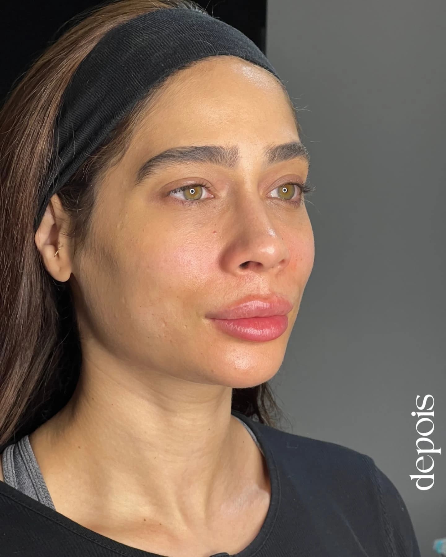 Depois